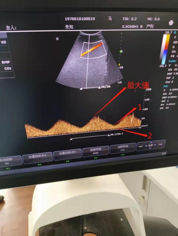 KS205D-1 型  多普勒体模与仿血流控制系统4.jpg